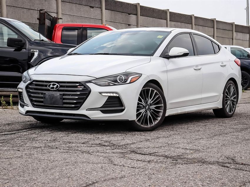 2017 Hyundai Elantra